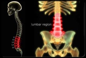 DENAS LUMBAR