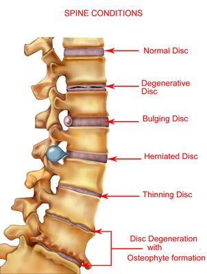 Denas Spine